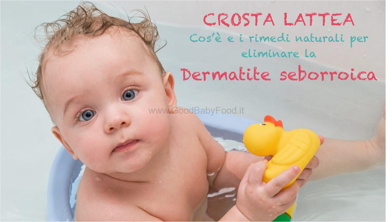 crosta lattea dermatite seborroica neonato